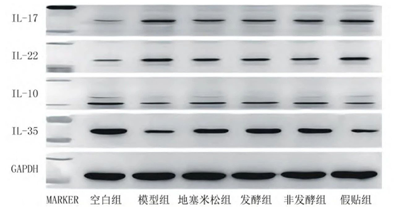 空白组和支气管哮喘各组大鼠肺组织中IL－17、IL－22、IL－10、IL－35蛋白表达电泳图